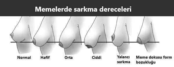 Göğüs sarkması erkekler sorun ediyor mu sizce?