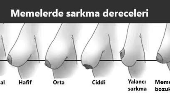 Göğüs sarkması erkekler sorun ediyor mu sizce?