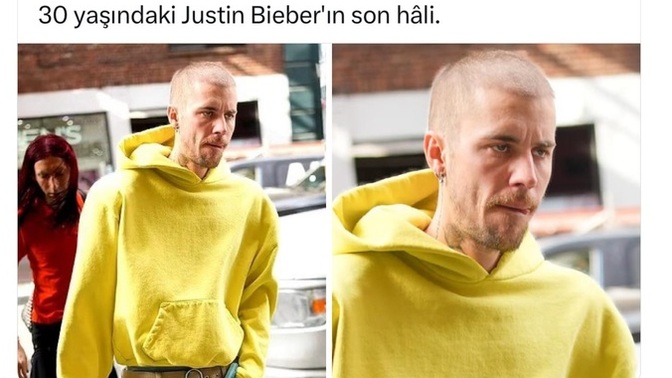 Justin Bieber 'i yolda görseniz bu hâliyle tanır mıydınız?