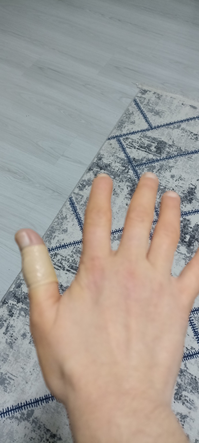 Yemek yaparken eliniz yaralandı mi?