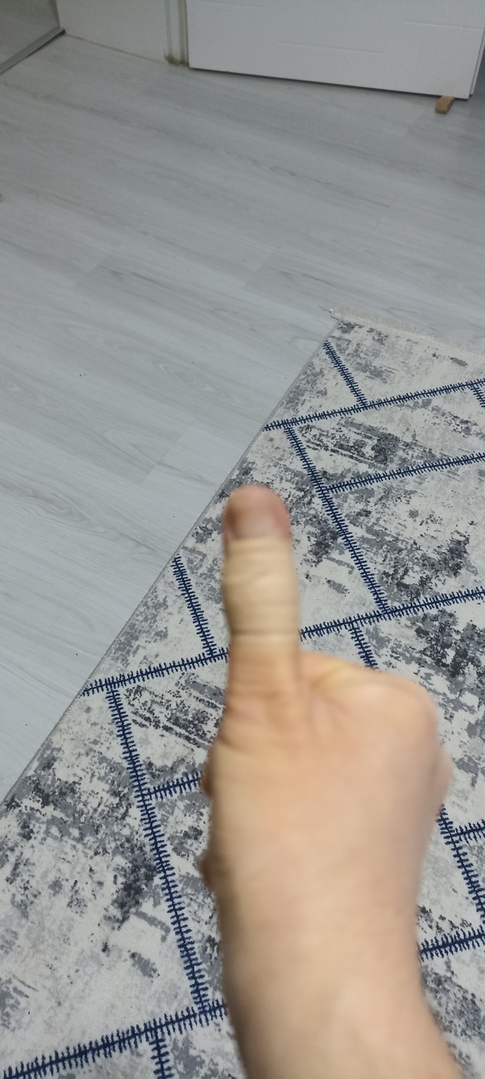 Yemek yaparken eliniz yaralandı mi?