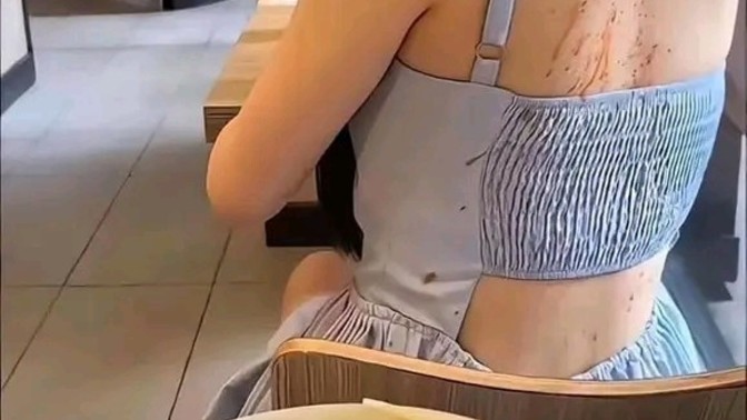 Yemek yerken birini rahatsız ettiniz mi?