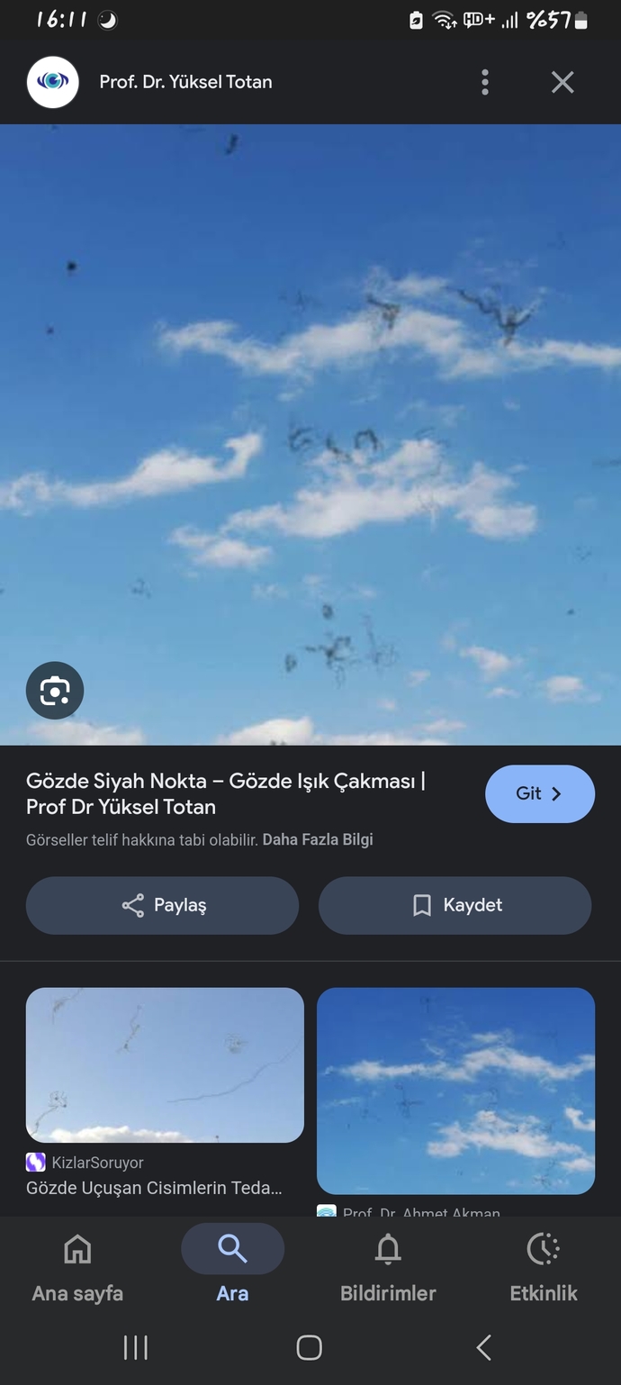 Göz onunde ucusan siyah noktalar?