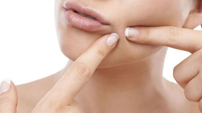 Sivilce çıkmasını önlemek için gerçekten süt ve süt ürünlerini bırakmak gerekiyor mu?