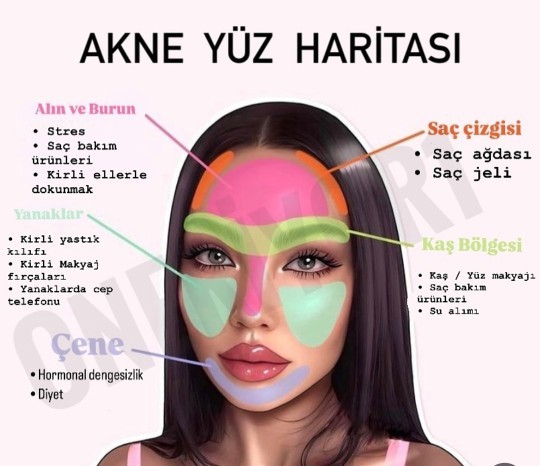 Zamansız çıkan sivilceler mi daha sinir bozucu yoksa ağrılı çıkan sivilceler mi?