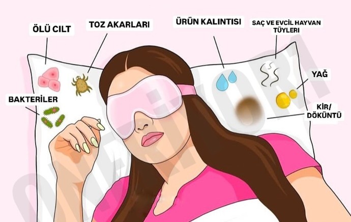 Zamansız çıkan sivilceler mi daha sinir bozucu yoksa ağrılı çıkan sivilceler mi?