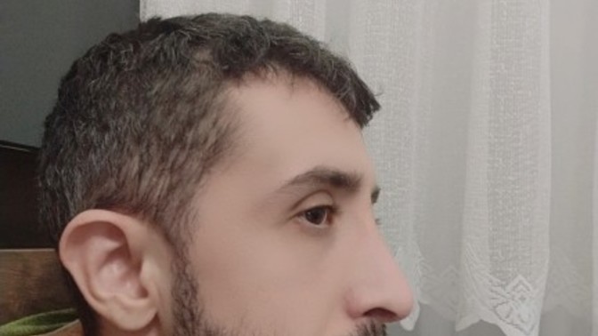 2. Ameliyatı olmalı mıyım?