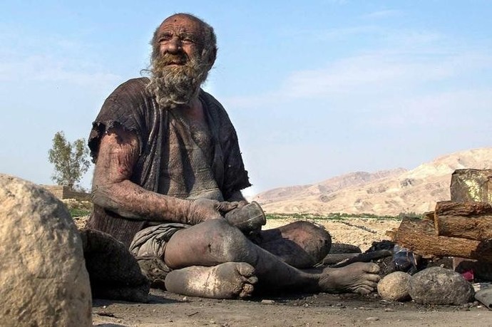 Temizlik hastalığı mi daha kötü pislik olma hastalığı mı sizce?