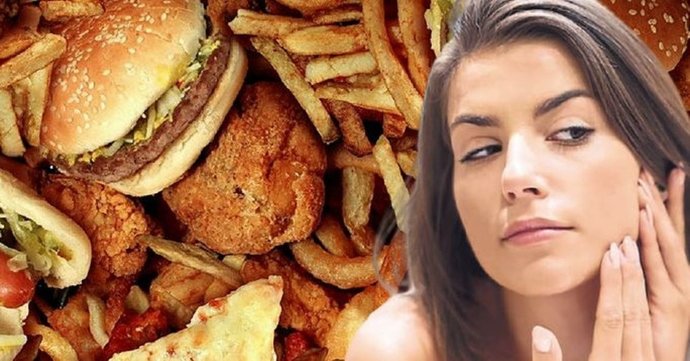 Fast food yediğinde sivilcelerin artıyor mu?