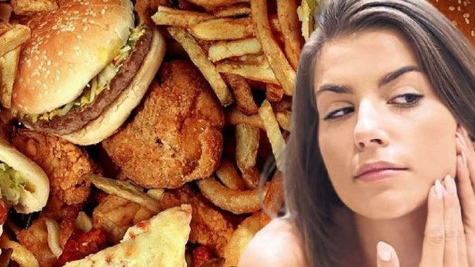 Fast food yediğinde sivilcelerin artıyor mu?