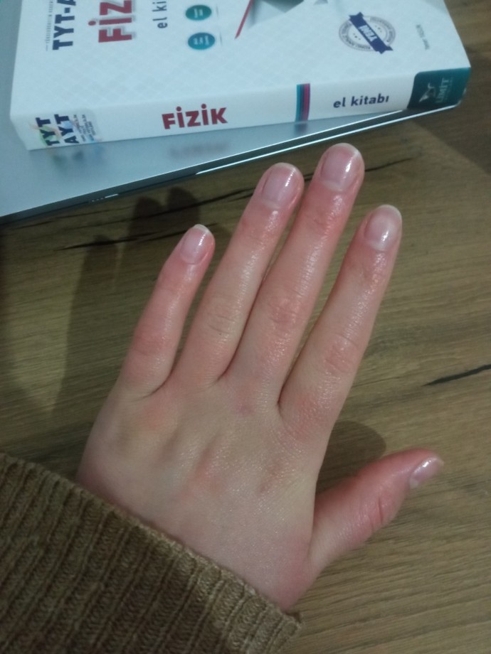 Parmaklarım kalın mı?