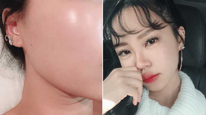 “Glass skin” modasına uymak mümkün mü? Pürüzsüz ve parlak cilde nasıl ulaşırız?