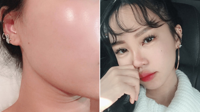 “Glass skin” modasına uymak mümkün mü? Pürüzsüz ve parlak cilde nasıl ulaşırız?