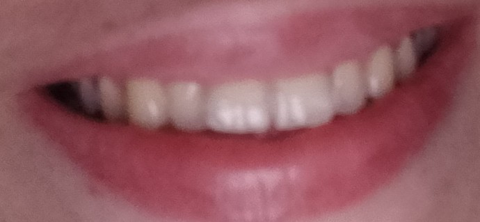 Dislerinizi fircaladiniz mi?