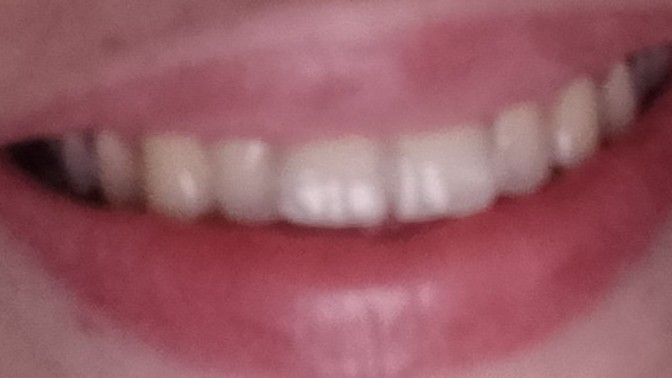 Dislerinizi fircaladiniz mi?