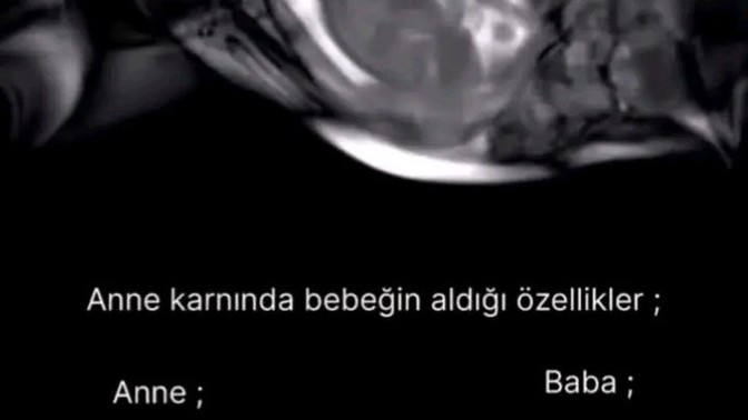 Anneden babadan ne özellik aldın?