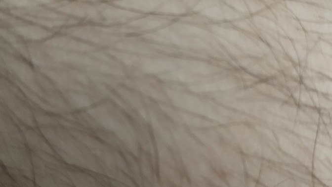 Bacak tüylerim ağdaya gittikten sonra bile hemen bir ay sonra böyle çıkıyor ne yapmalıyım?