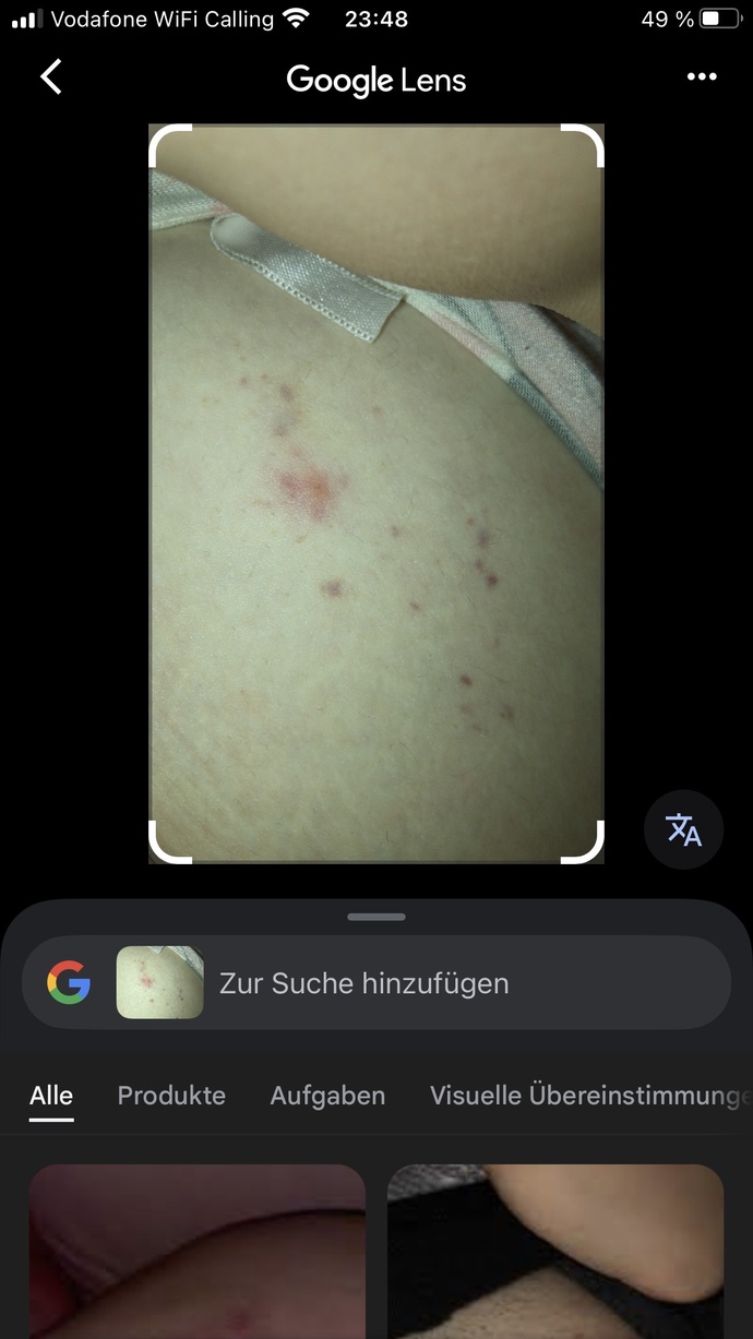 !!!‼️Yatagimda tahta kurusu mu var ‼️Acil yardim ?