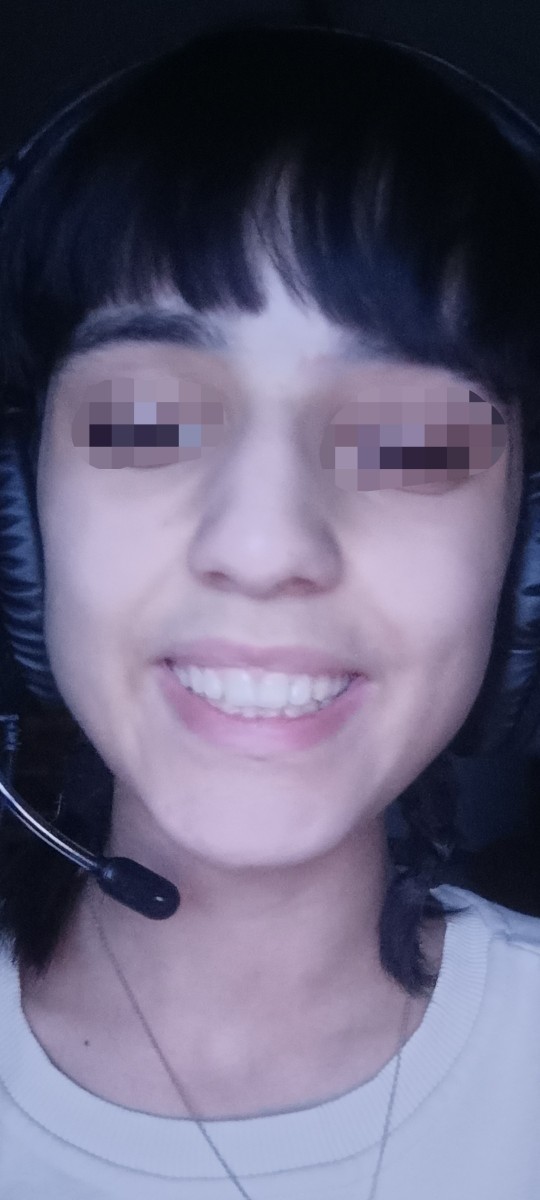 Benim böyle çirkin cikmami sağlayan şey ne aw?