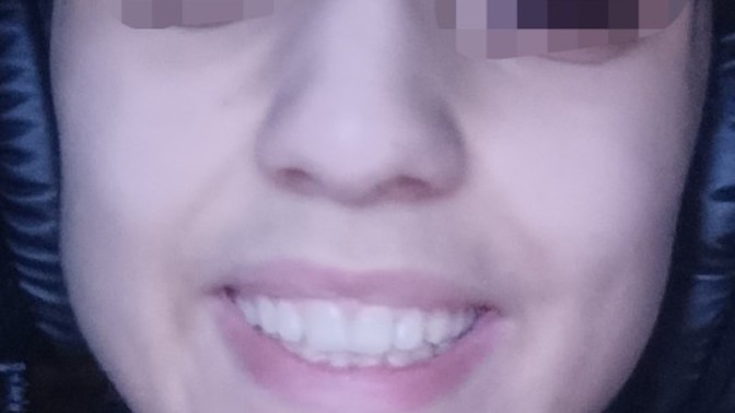 Benim böyle çirkin cikmami sağlayan şey ne aw?
