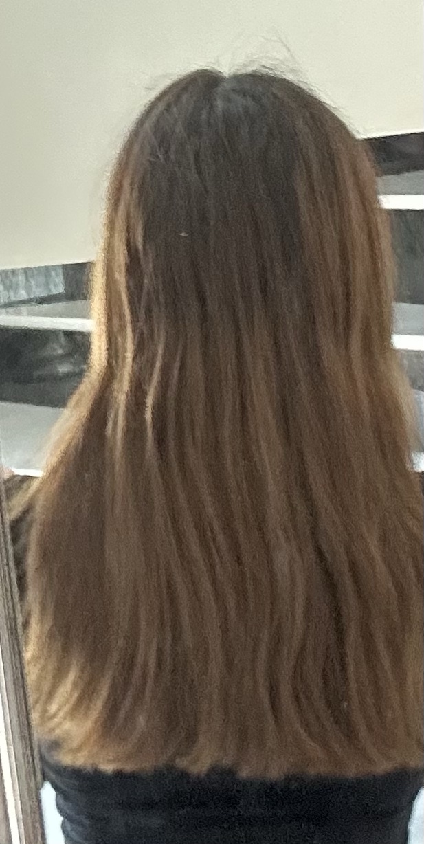 Saçım seyrelmiş mi sizce?