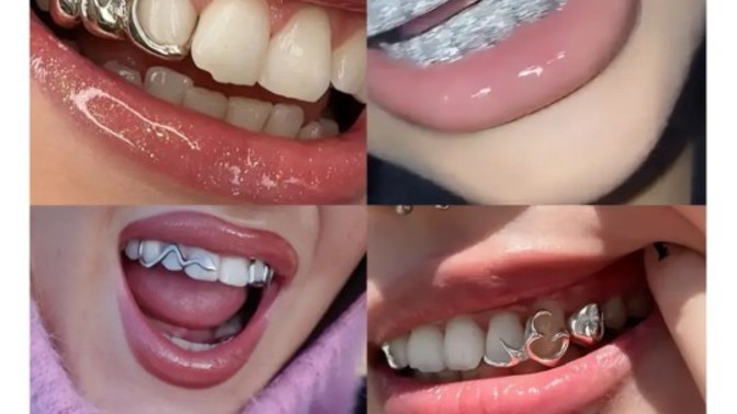 Grillz hakkında ne düşünüyorsunuz?