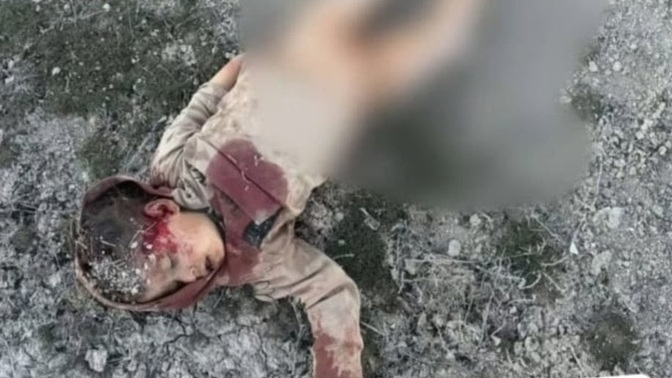 Sokak köpekleri tarafından parçalanıp öldürülen 2 yaşındaki çocukların olduğu bir ülkede mi yaşamak istiyoruz?