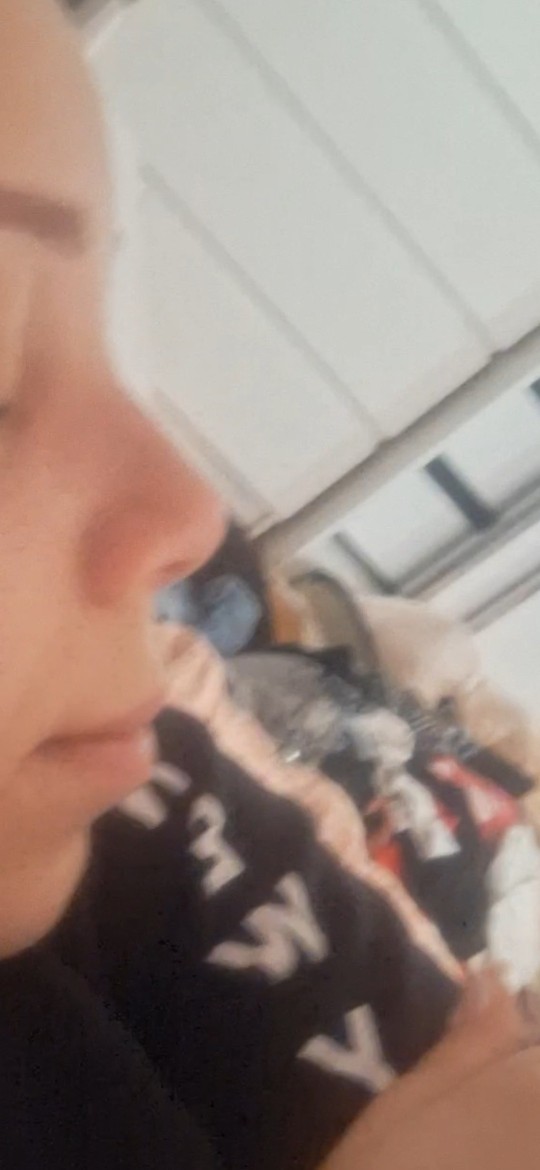 Koreli burnumda kemik varmış napıcam?