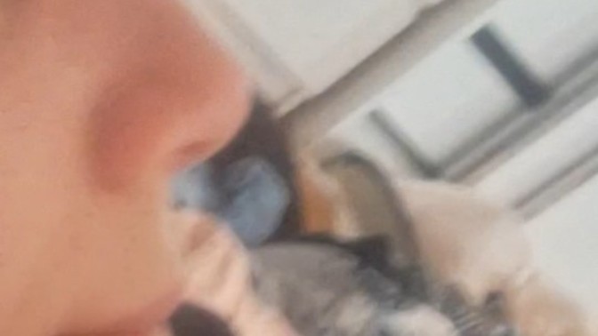 Koreli burnumda kemik varmış napıcam?
