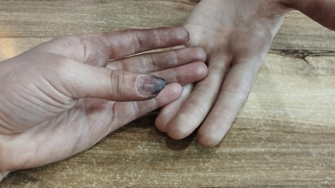 Arkadaşımın saçını siyaha boyarken boya elimi mahvetti boyayı elimden nasıl çıkarabilirim?