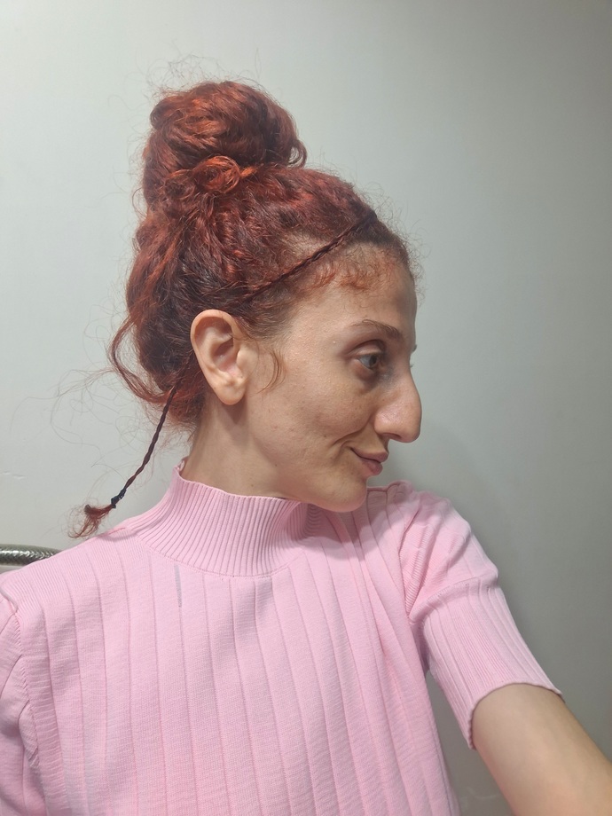 Kusur olarak gördüğünüz bir organınız var mı?