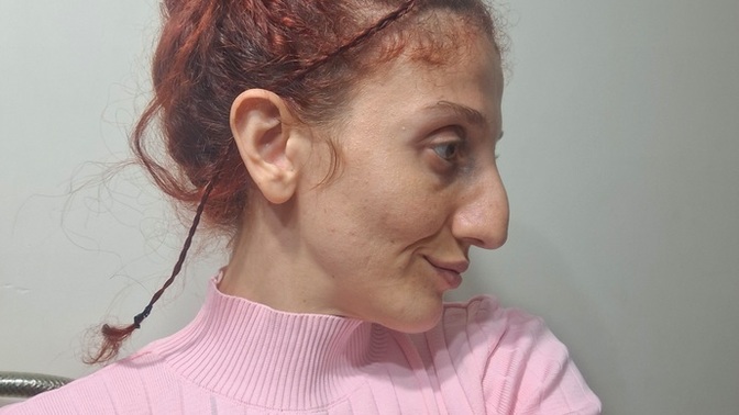 Kusur olarak gördüğünüz bir organınız var mı?