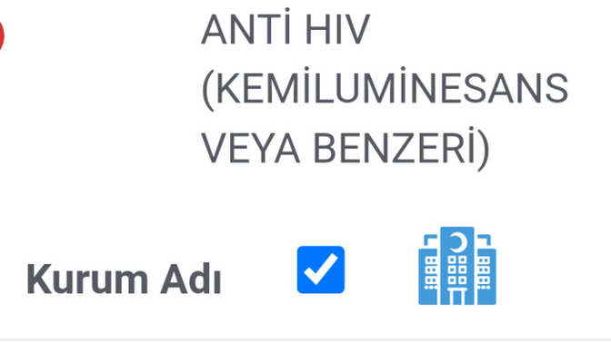 Bu hıv testi negatifmi pozitifmi pozitiflik şüphesi veya pozitifliğe yakınlık var mı?