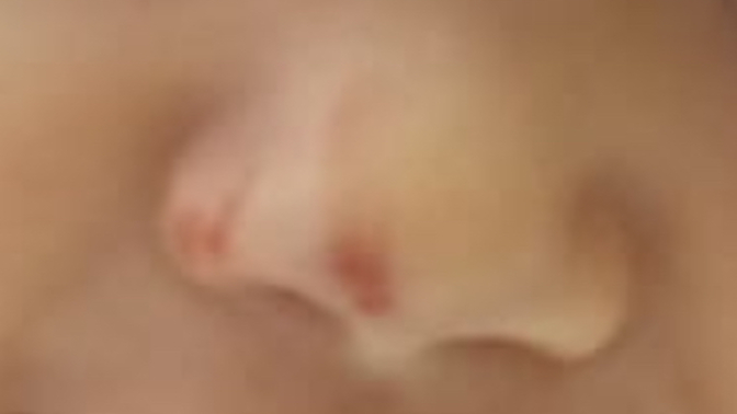 8 aylık bebek koltuktan düştü burnu böyle oldu bişe olur mıu?