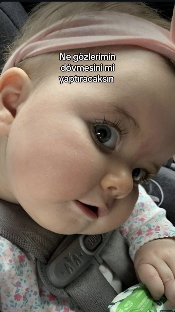 Konuyla alakası yok ama çok tatlı bebiş diye ekledim. d