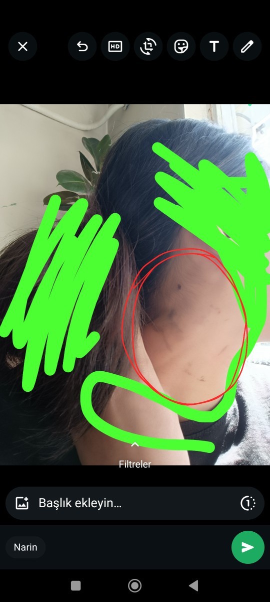 Arkadaşlar sacimin birazini siyaha boyiyayim derken boynumu boya yaptim vw gecmiyor yarin okula nasil gidecemmm?
