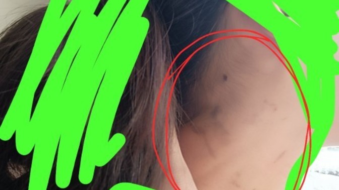 Arkadaşlar sacimin birazini siyaha boyiyayim derken boynumu boya yaptim vw gecmiyor yarin okula nasil gidecemmm?
