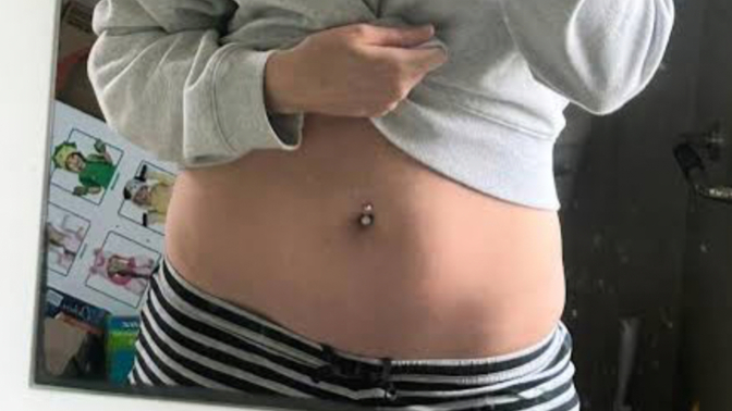 Piercing yaptırdım hoşuma gitmedi çıkartsam kötü mü olur delik izi?