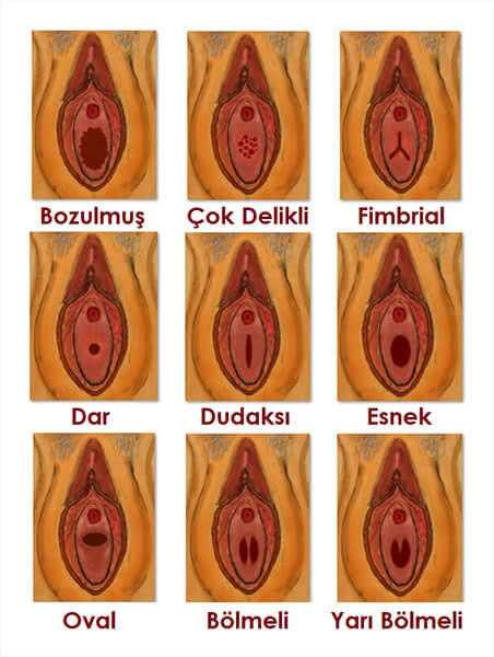 Çok korkuyorum Acaba Kızlık Zarı'm gitmişmidir?