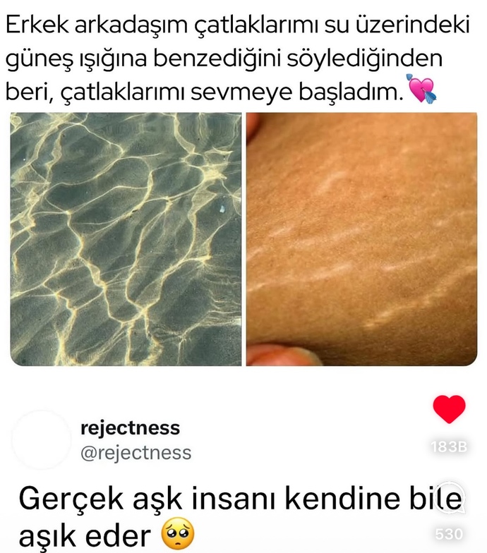 Sevgilinin ufak kusurlarını bile sevmek , var mı böyle ya?