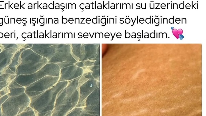 Sevgilinin ufak kusurlarını bile sevmek , var mı böyle ya?