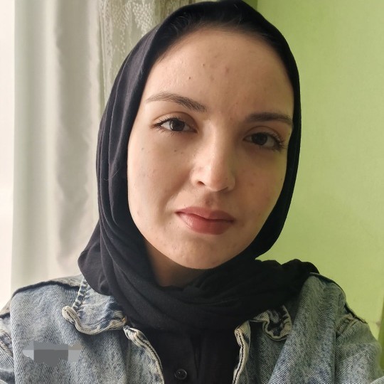 Dudagımn üstü ve kaşımn altndaki beni aldırmalı mıyım sizce nasıl duruyor?
