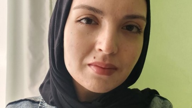 Dudagımn üstü ve kaşımn altndaki beni aldırmalı mıyım sizce nasıl duruyor?