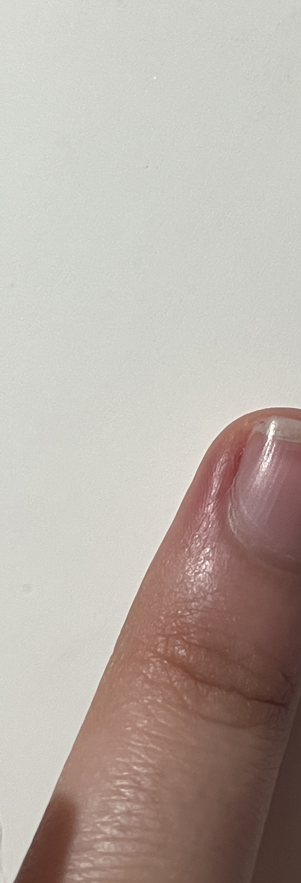 Niye böyle olmuş?