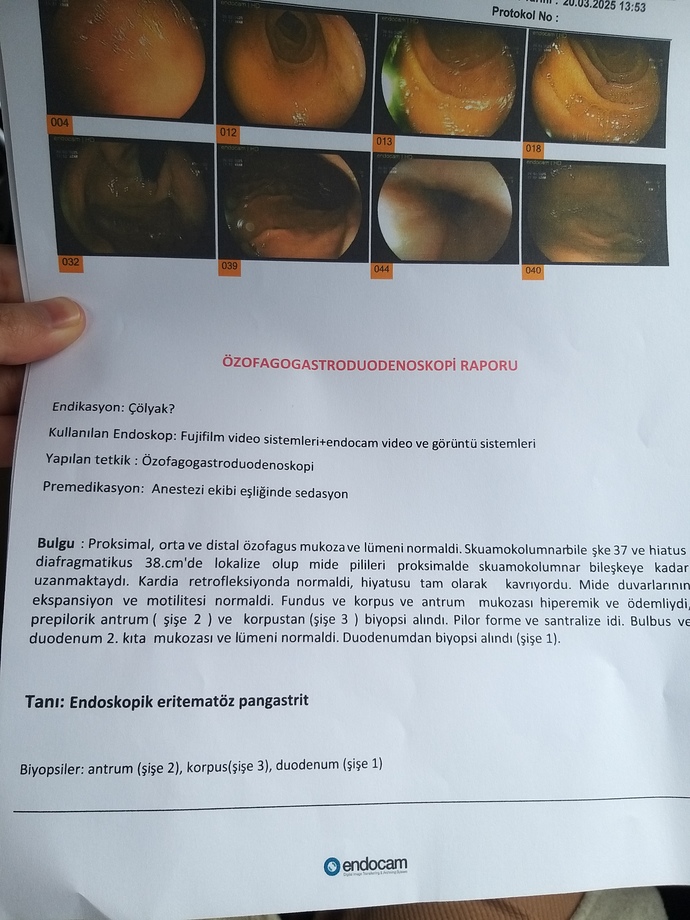 Endoskopi ve kolonoskopi sonucunu bırakıyorum anlayanlar bakabilir mi?