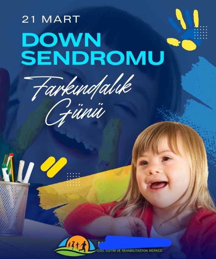 21 Martın Dünya Down Sendromu Farkındalık Günü olduğunu biliyor muydunuz?