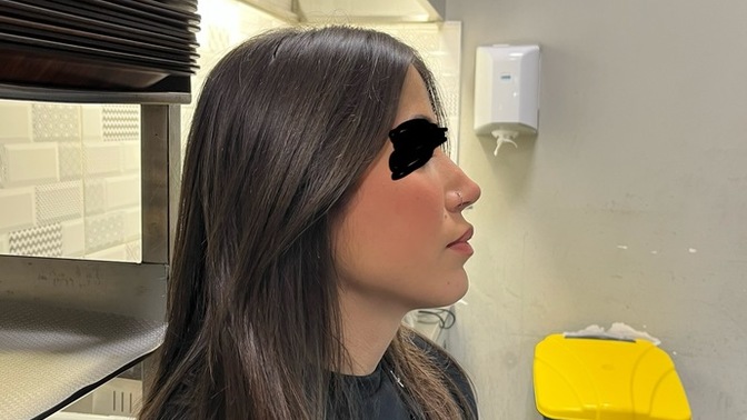 Çenem çok ilerde?