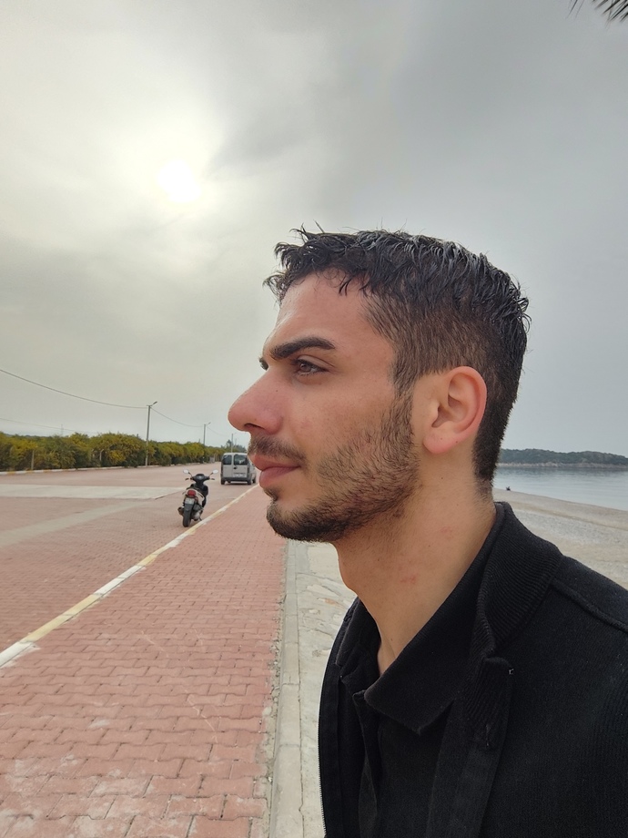 Burun estetiği sonrasi?