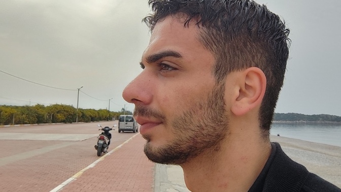 Burun estetiği sonrasi?