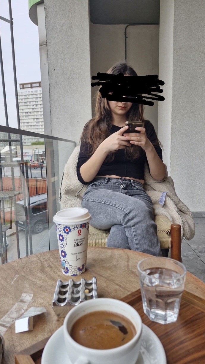 Dudaklarıma dolgu yaptırsam baya değişir miyim?
